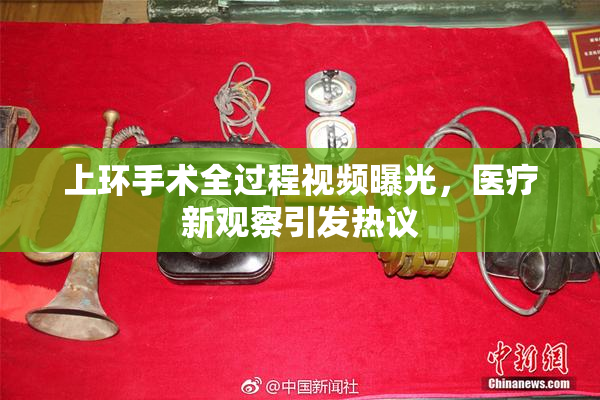 上环手术全过程视频曝光，医疗新观察引发热议