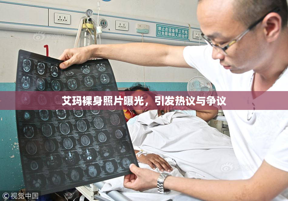 艾玛裸身照片曝光，引发热议与争议