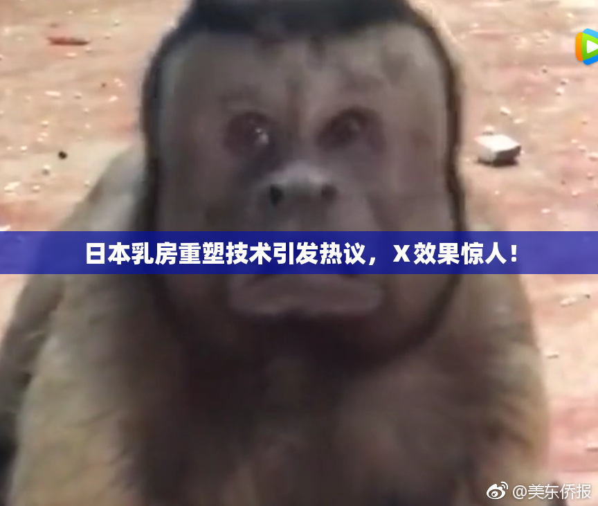 日本乳房重塑技术引发热议，Ⅹ效果惊人！