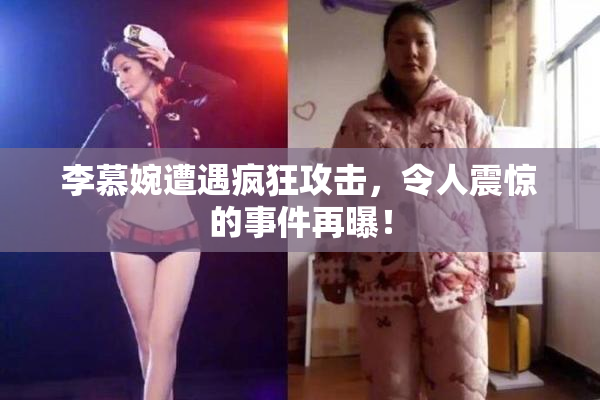 李慕婉遭遇疯狂攻击，令人震惊的事件再曝！