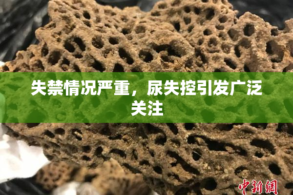 失禁情况严重，尿失控引发广泛关注