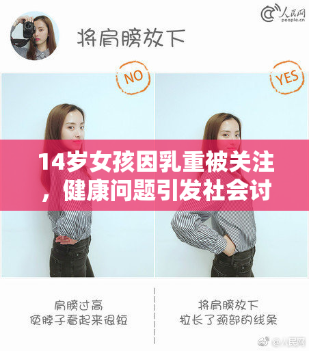 14岁女孩因乳重被关注，健康问题引发社会讨论