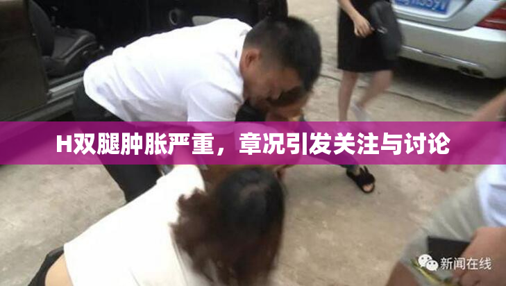 H双腿肿胀严重，章况引发关注与讨论