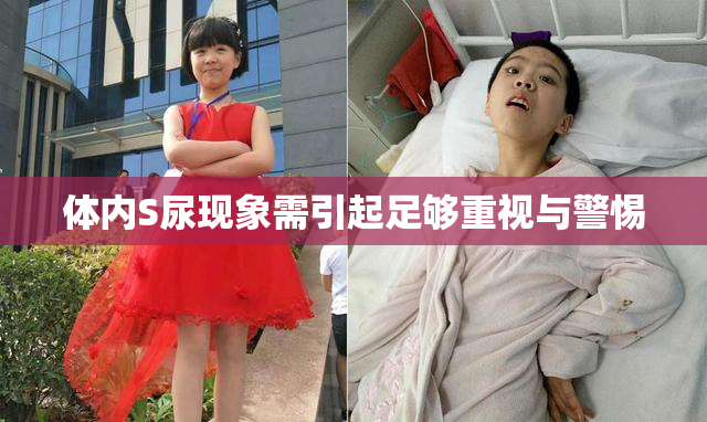 体内S尿现象需引起足够重视与警惕