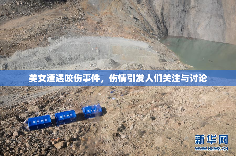 美女遭遇咬伤事件，伤情引发人们关注与讨论