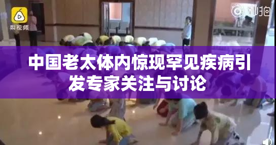中国老太体内惊现罕见疾病引发专家关注与讨论