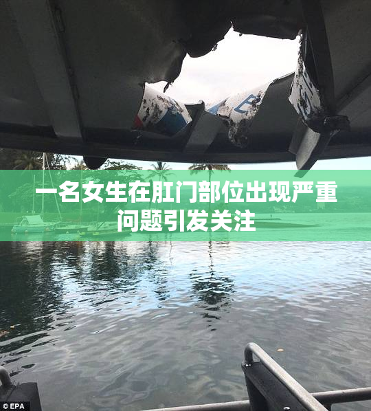一名女生在肛门部位出现严重问题引发关注