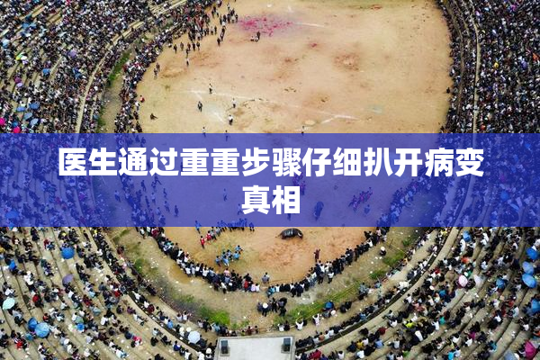 医生通过重重步骤仔细扒开病变真相