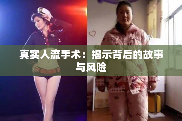 真实人流手术：揭示背后的故事与风险
