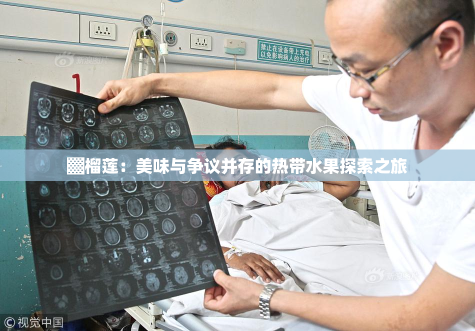 ▓榴莲：美味与争议并存的热带水果探索之旅