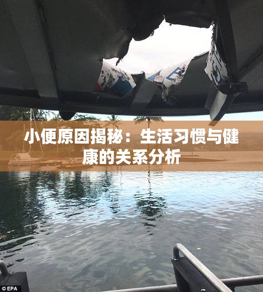 小便原因揭秘：生活习惯与健康的关系分析