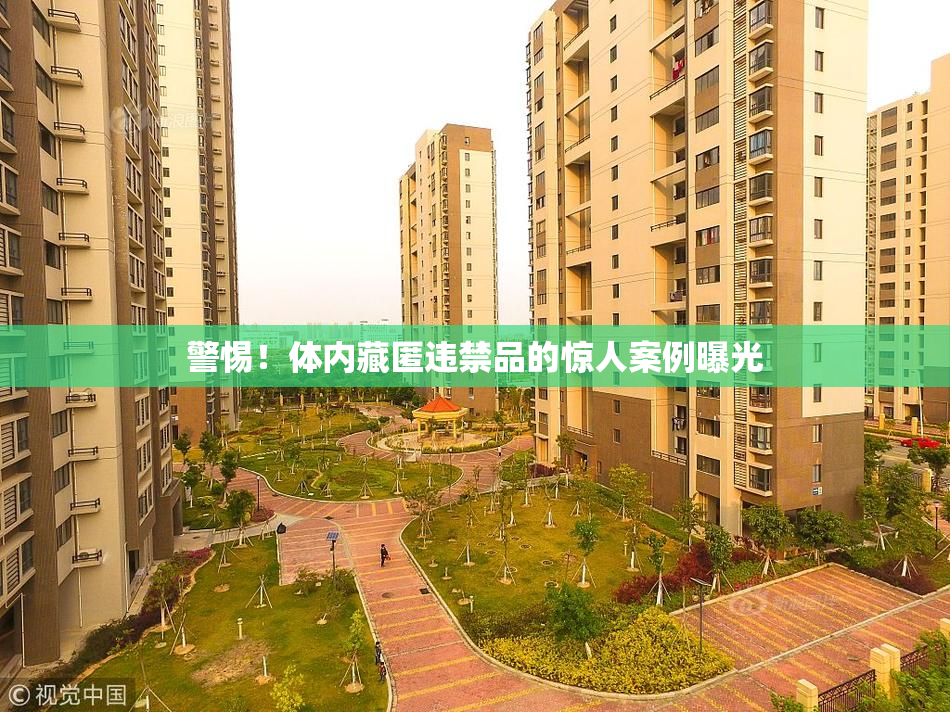 警惕！体内藏匿违禁品的惊人案例曝光