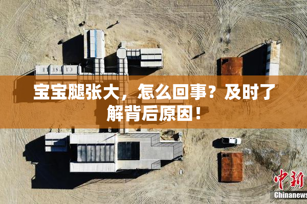 宝宝腿张大，怎么回事？及时了解背后原因！