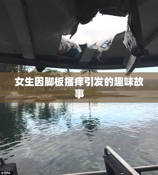 女生因脚板瘙痒引发的趣味故事