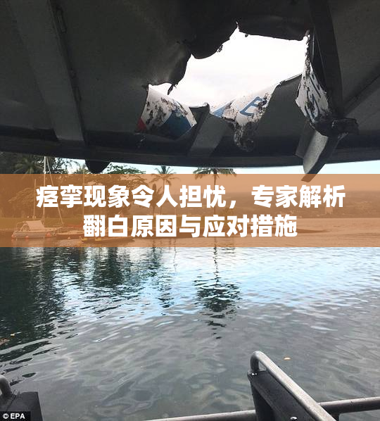 痉挛现象令人担忧，专家解析翻白原因与应对措施
