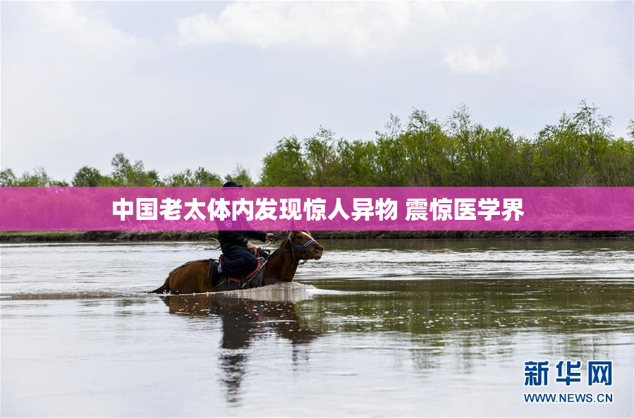 中国老太体内发现惊人异物 震惊医学界